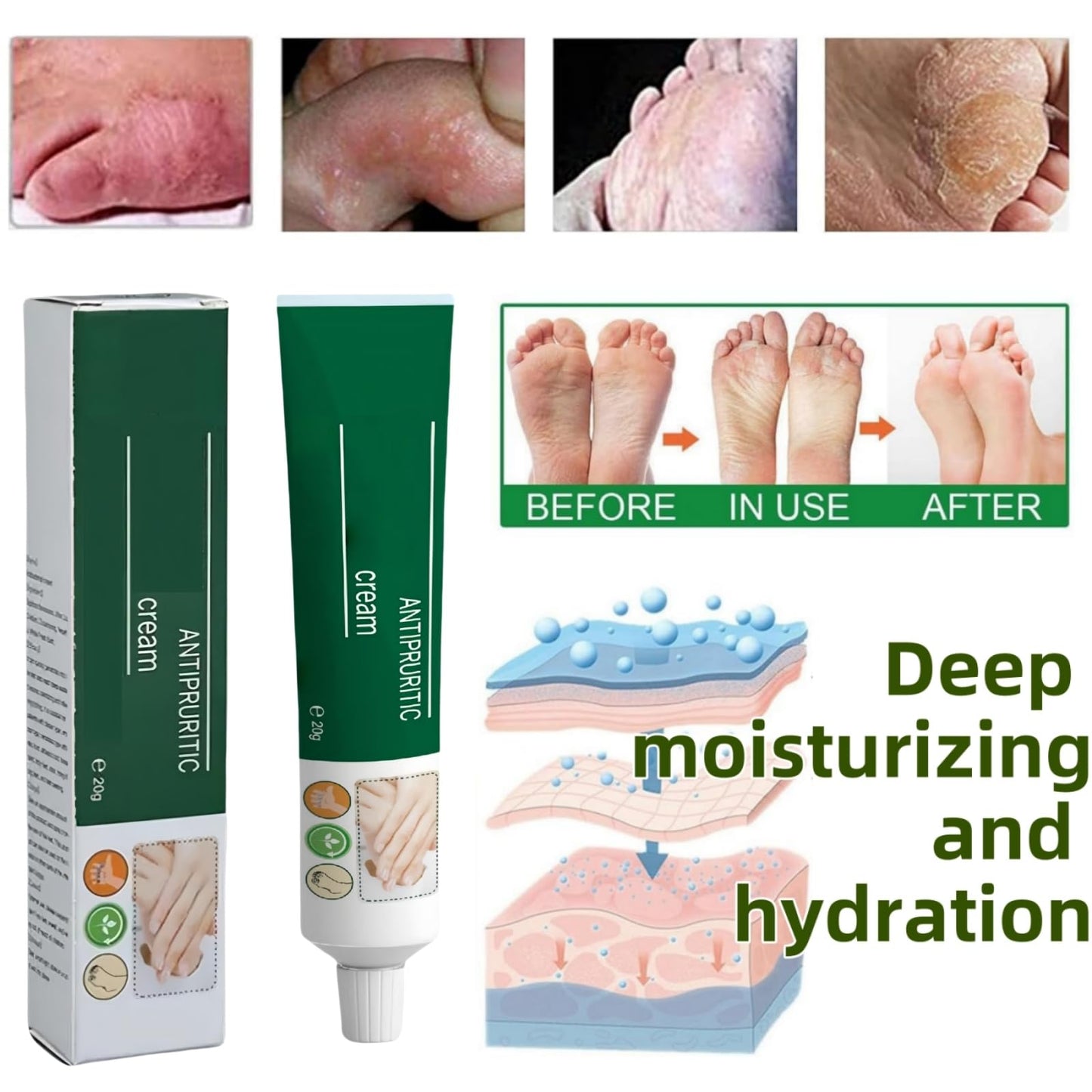 Yoowan Foot Cream For Cracked Heels And Dry Skin,Cracked Heel Repair Cream,Hard Skin Remover Foot C-ream,Dry Feet Treatment,Repairing Cracked Heel And Itchy Feet,Hydrate&Soften,For Heels,Knees,Elbows&Hands