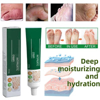 Yoowan Foot Cream For Cracked Heels And Dry Skin,Cracked Heel Repair Cream,Hard Skin Remover Foot C-ream,Dry Feet Treatment,Repairing Cracked Heel And Itchy Feet,Hydrate&Soften,For Heels,Knees,Elbows&Hands