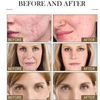 Anti Aging Firming Body Cream,Bee Ven-Om Cream,Bee Ven-Om Cre-Am For Wrinkles,Skin Firming Body Cre-Am,Restore Elasticity,Hydrate And Moisturize,Brighten Skin Tone,Non-Irritating,For Body And Face