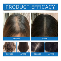 2pcs Sea/Puri Scalp Serum,Scalp Cooling Hair Roll-on Massage Essence,Hair Serum for Hair Loss,Scalpy Hair Growth Serum for Men & Women,Strengthening Soothing Hair Essences,Improves Shine