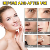 Deep Vita C Capsule Cream,Skin Tightening Cream for Face,Deep Vitamin C Golden Capsule Face Moisturizer,Vitamin C Serum,Vita C Golden Caps/ules FA/ce Mois/turizer,FA/ce Moistu/rizer for Women
