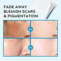 Dark Spot Remover for Face Cream, Niacinamide + Tranexamic Acid Cream for Freckles, Hyperpigmentation, Age Spots, Blemishes, Melasma, Dark Spot Cream, Korean Skin Care, 50ml