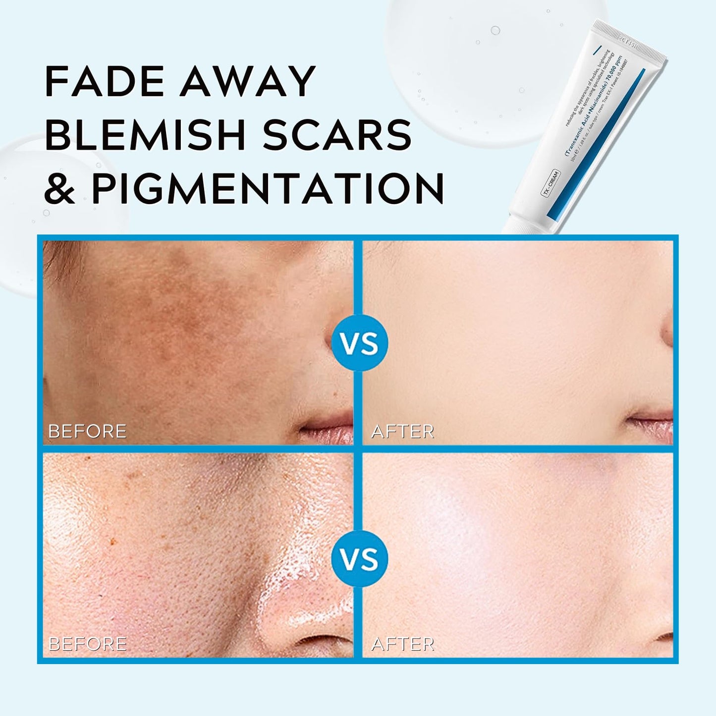 TBeautfave Dark Spot Remover for Face Cream, Niacinamide + Tranexamic Acid Cream for Freckles, Hyperpigmentation, Age Spots, Blemishes, Melasma, Dark Spot Cream, Korean Skin Care, 50ml