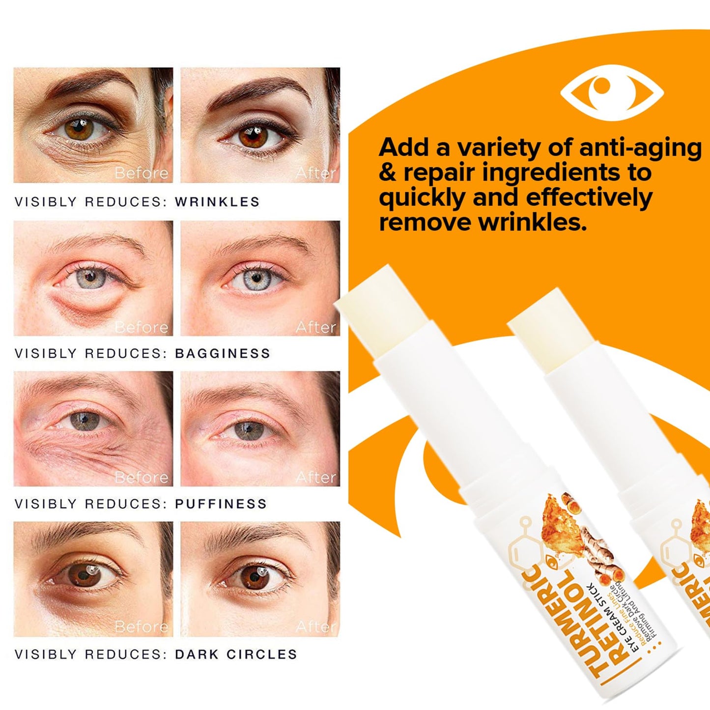 2PCS Lumibalm - Eye Cream for Dark Circles and Puffy Eyes - Lumistick with Turmeric Retinol - Anti Wrinkle Eye Cream Reduce Fine Line - Eye Moisturiser for Dry Skin - Firming and Lifting