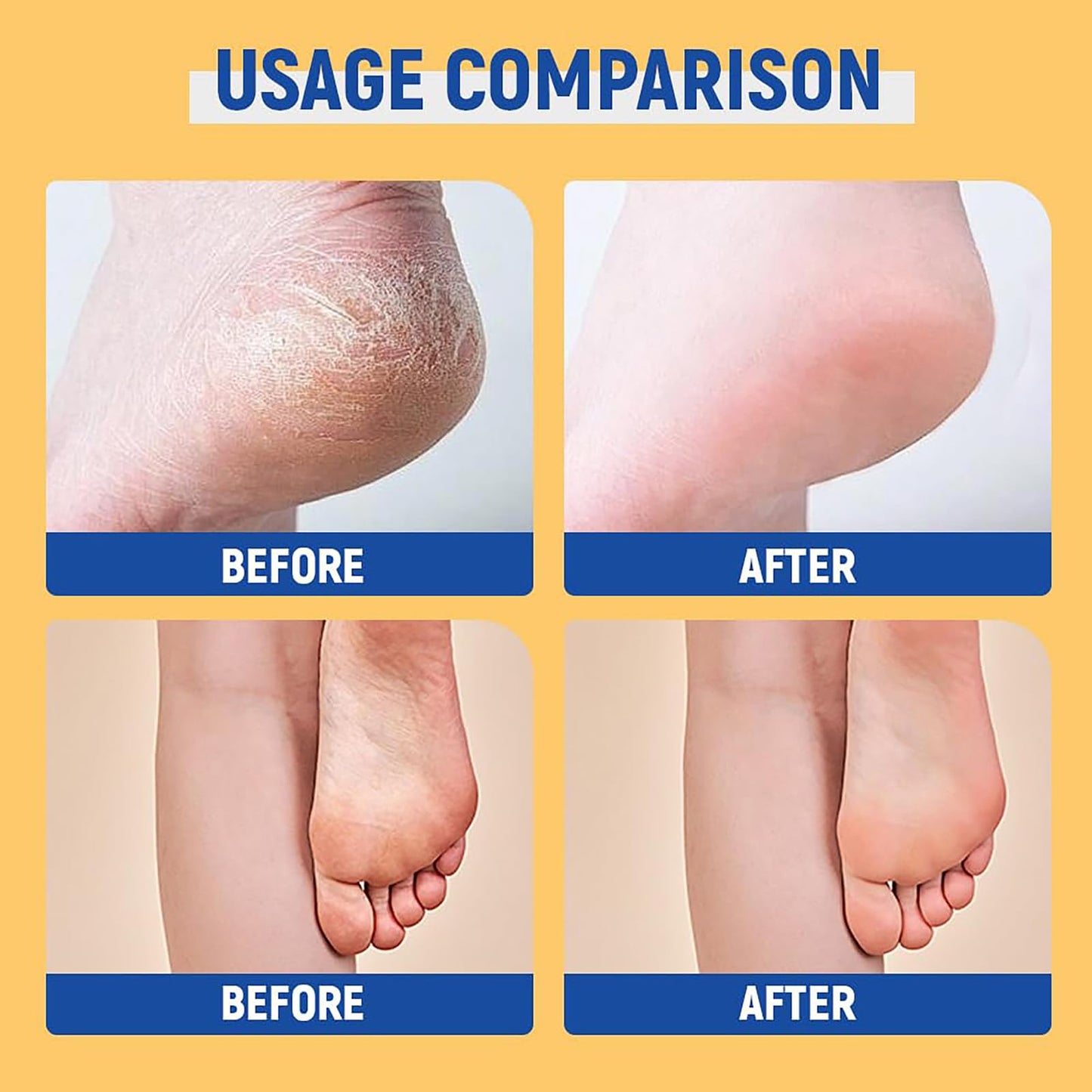 HERBINSOLS Urea Cream 60% for Feet - 2PCS Urea Foot Cream for Cracked Heels and Dry Skin - Cracked Heel Repair Cream with 2% Salicylic Acid - Foot Moisturiser & Hand Balm,Skin Care Hands & Feet