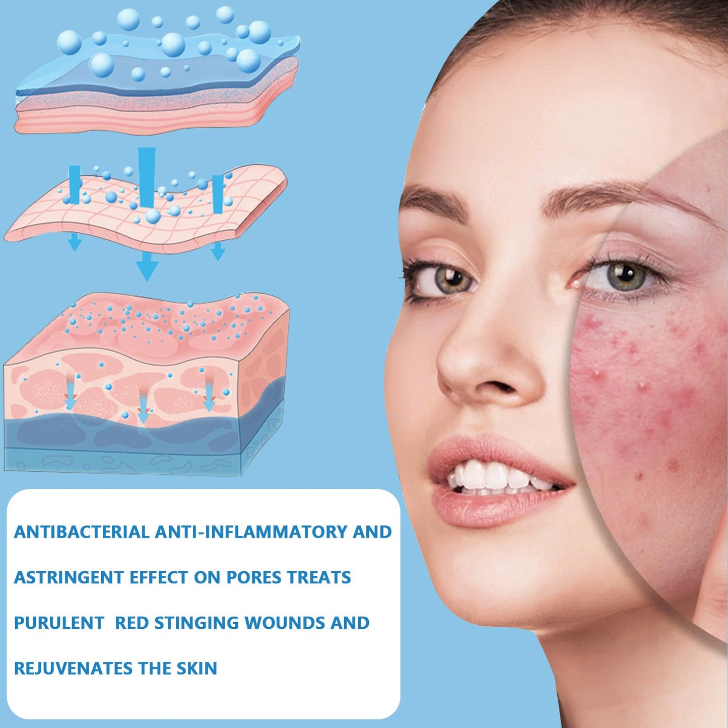 FunnAura 5PCS Micro Infusion Facial System, With Serum Beauty Lips Kit for All Skin Types