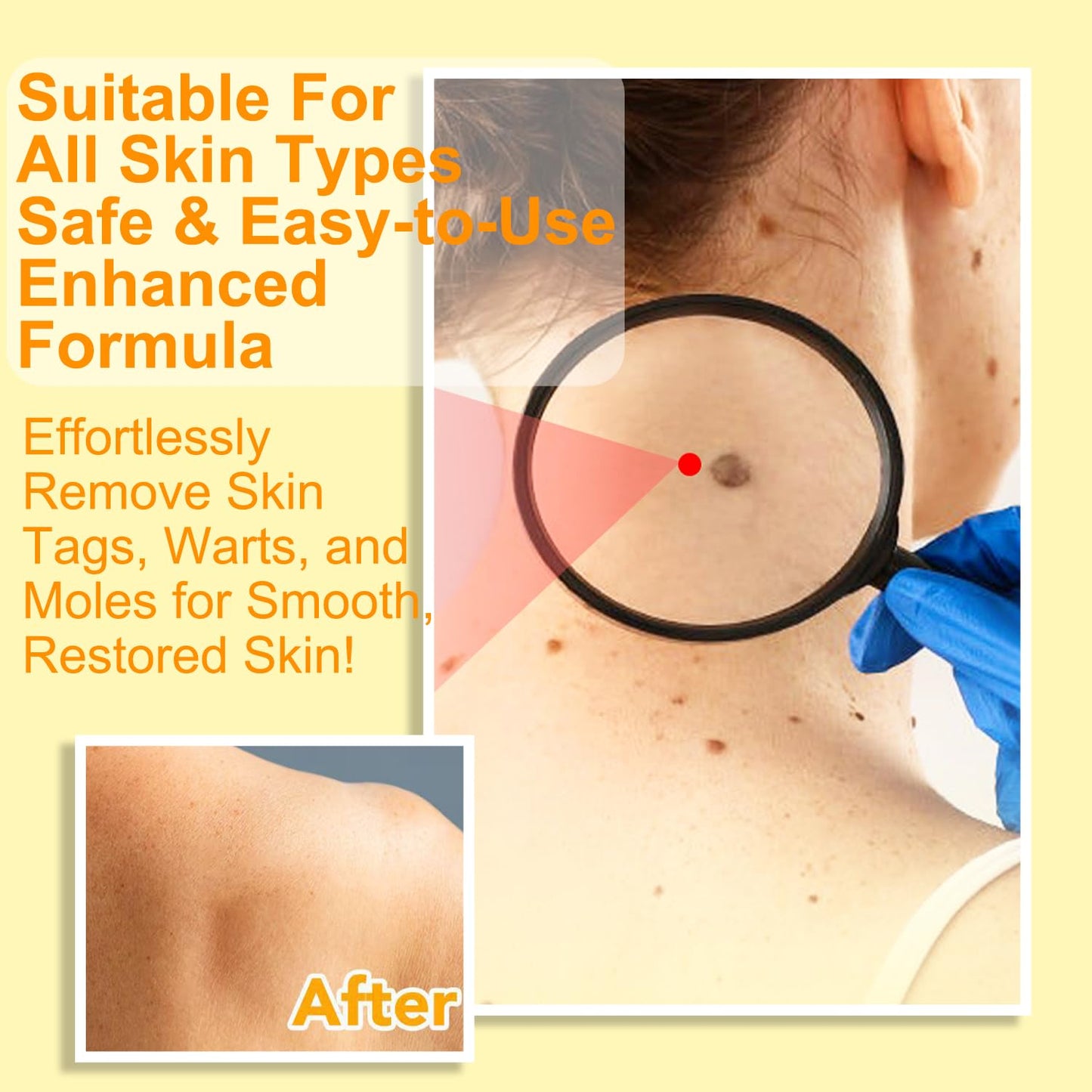 Generic Bee Venom Cream, 2024 New Upgrade Bee Venom Treatment Cream, for Wrinkles and Dry Skin & Dry Skin Bee Venom Wart & Moles Removal Cream Skin Moisturiser -Bee Venom All in One Cream for Body & Face Bee