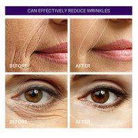 Tongyend Retinol Intense Reactivating Serum, Retinol Serum For Face - Resurfacing Retinol Serum, Barrier Serum For Anti Aging & Wrinkle Reduction, Retinol Moisturiser Face Serum For Women Mature Skin