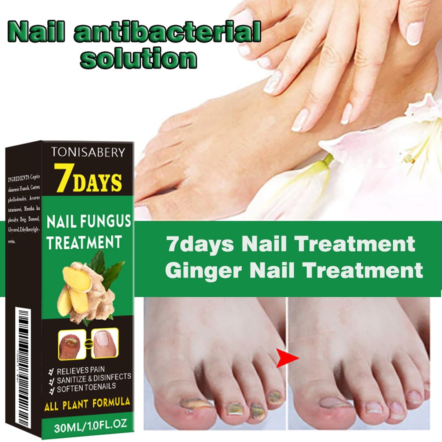 Ginger Nail Treatment Nail Support Nail Care - Ginger Nail Growth Serum, 7 Days Nail Treatment, Ginger Cuticle Care Oil for Nails, Nail Strengthener For Damaged Nails, Fungal Nail Treatment