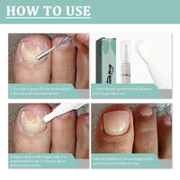 Nail Care Pens, 5Pcs Fungal Nail Treatment Pens, Fungal Nail Treatment for Toenails, Nail Repair Pen, Natural Ingredients Nail Serum for Strengthener Nail
