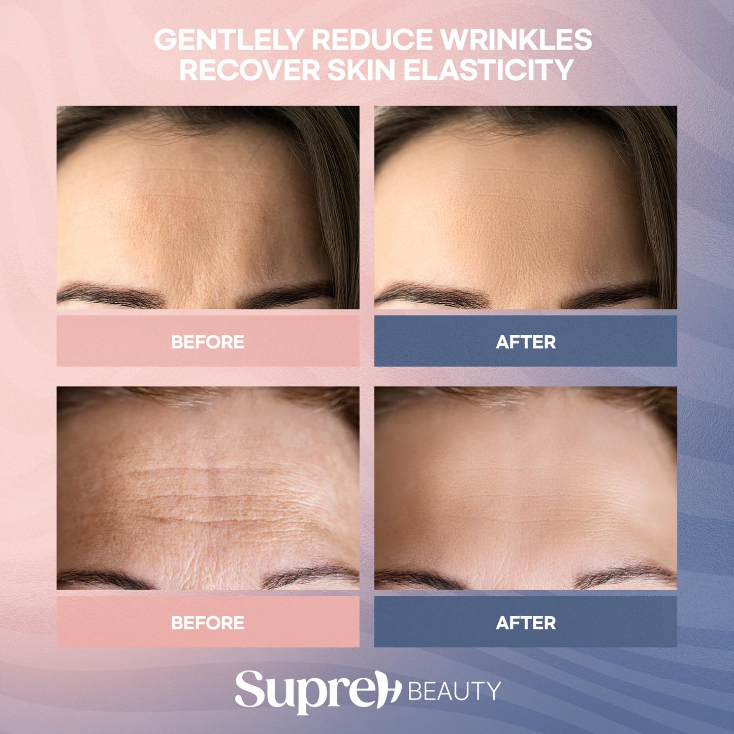 SupreH Forehead Wrinkle Patches Smoothing Overnight: Anti Wrinkle Patches for Face and Forehead Fine Lines & Frown Lines - with Peptide Collagen Hyaluronic Acid 10