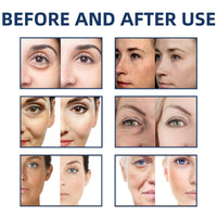 Oumun Retinol Facial Firming Stick,Collagen Firming Serum Stick,Neck and Face Serum Care Stic-k,Collagen Firm-ing Cream Stic-k,Anti-Aging Face Moisturizer,Hydrating Seru-m Sti-ck,Colla-gen Sti-ck