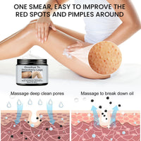 Strawberry Legs Treatment,Keratosis Pilaris Treatment,Skin Exfoliating Repair Lotion,Keratosis Pilaris Cream,Moisturizing Strawberry Skin Smooth Radiant Body Lotion,Body Care for Women Men