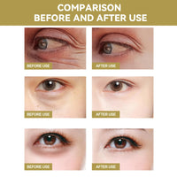 SingHao 3pcs Anti Wrinkles Micro Needle Patches,Dissolving Microneedle Eye Patches,Anti Wrinkle Patches,Under Eye Patches,Dark Circles & Puffiness Treatment,Under Eye Mask,Micro Needle Patches for Women