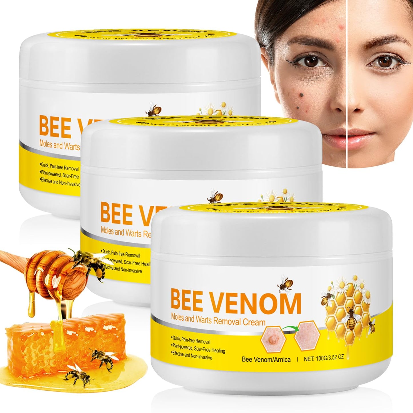 Generic Bee Venom Cream, 2024 New Upgrade Bee Venom Treatment Cream, for Wrinkles and Dry Skin & Dry Skin Bee Venom Wart & Moles Removal Cream Skin Moisturiser -Bee Venom All in One Cream for Body & Face Bee