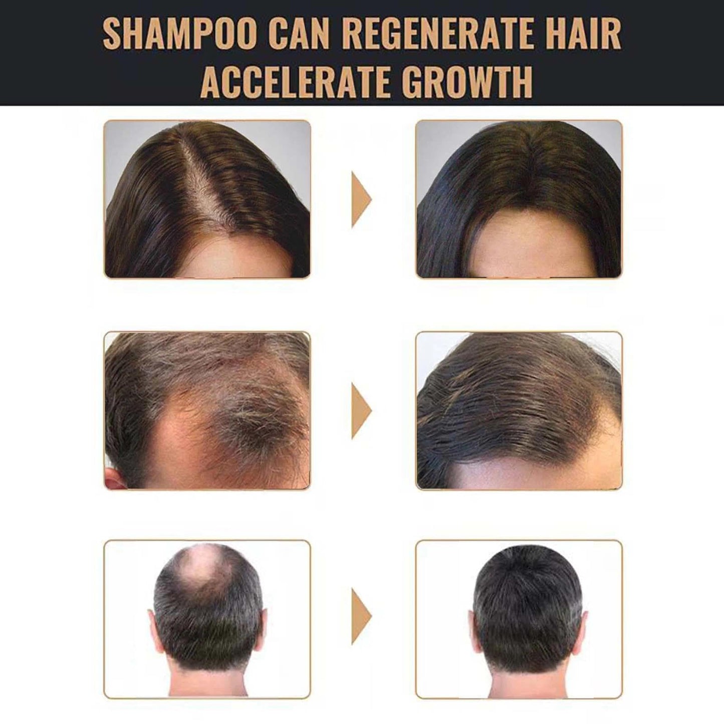 AurolaGlow 2PCS Mane Shampoo for Men &Reduces Grey Hair. Hair Thickening Shampoo for Men and Women -Thinning Hair& Promotes Natural Darkening &Stimulates Regrowth, and Prevents Hair Loss