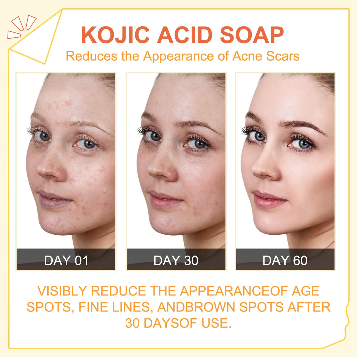 Peak Health Whitening Kojic Acid Soap Facial Bleaching Dark Spot Acne Scars Skin Brighter Lightening Detox Pigmentation Removal Reduce (Pack of 1)