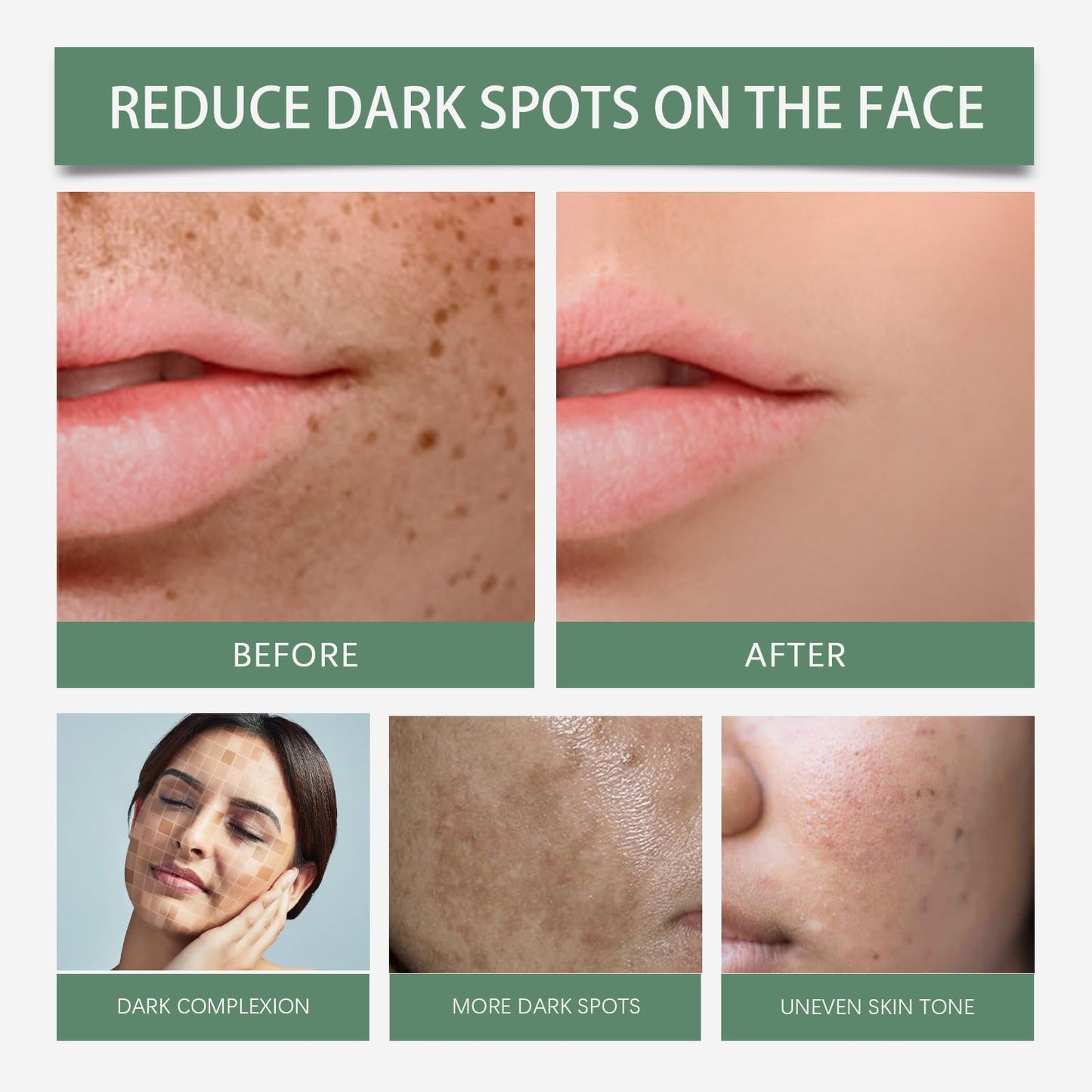 Spots Removal Serum, Niacinamide Serum for Face, Dark Spot Correcting Glow Serum
