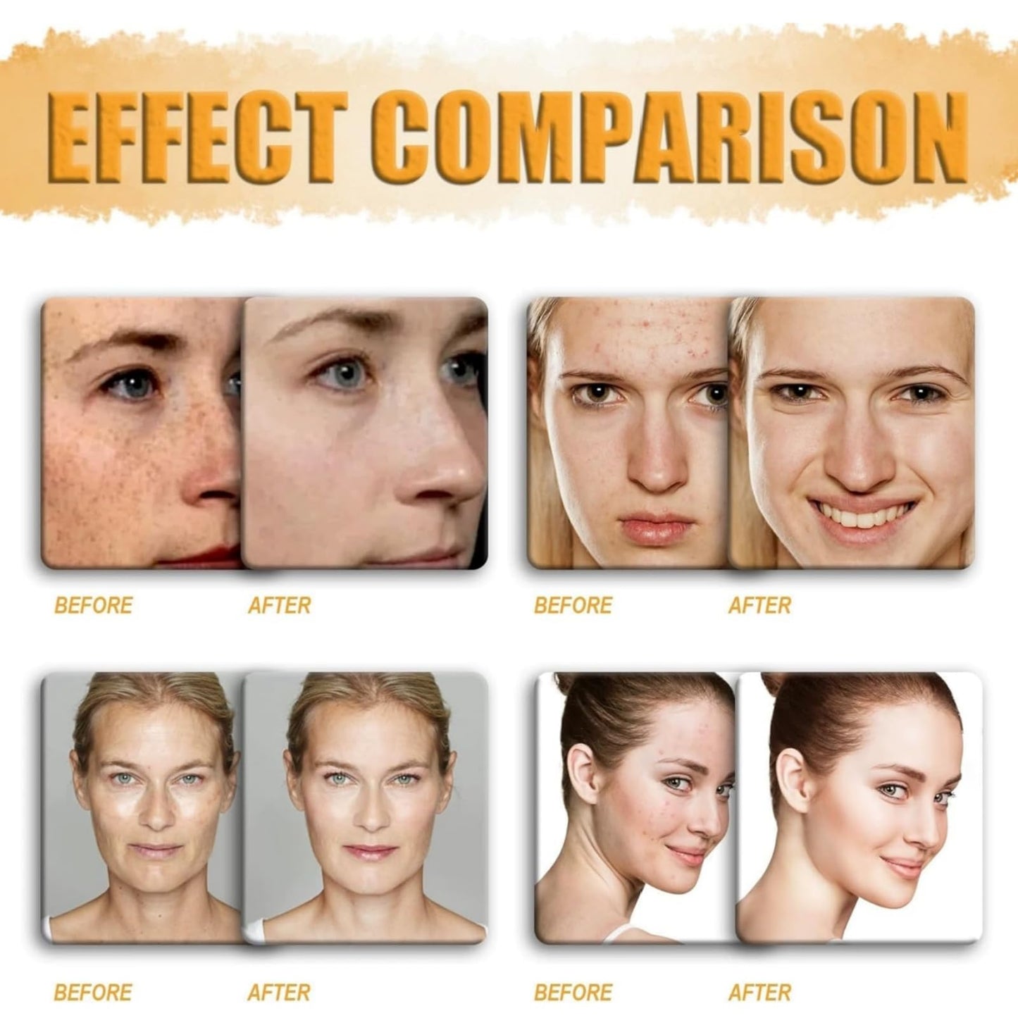 Multi-Effect Al-In-One Skincare Cream,Bee Ven-Om Skin Treatment Cream,Bee Ven-Om Comprehensive Cre-Am,B-Ee Ve-Nom Face Cre-Am,Skin Repair Lotion,Moisturize And Lift,Anti-Aging Balm For Face And Body