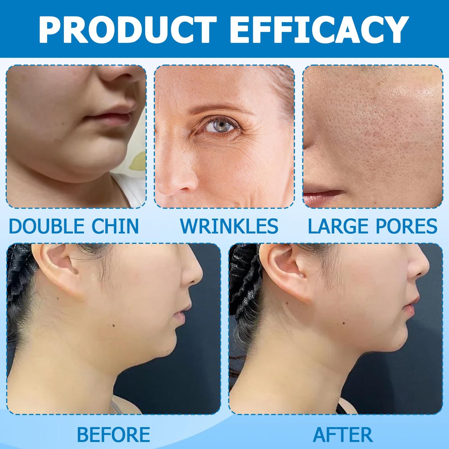 Bisienya V Line Face Lifting Chin Mask,Chin Lift Mask Face,Nourishes The Skin Lifts and Tightens Gentle, Safe and Comfortable Care Suitable for Both Men and Women