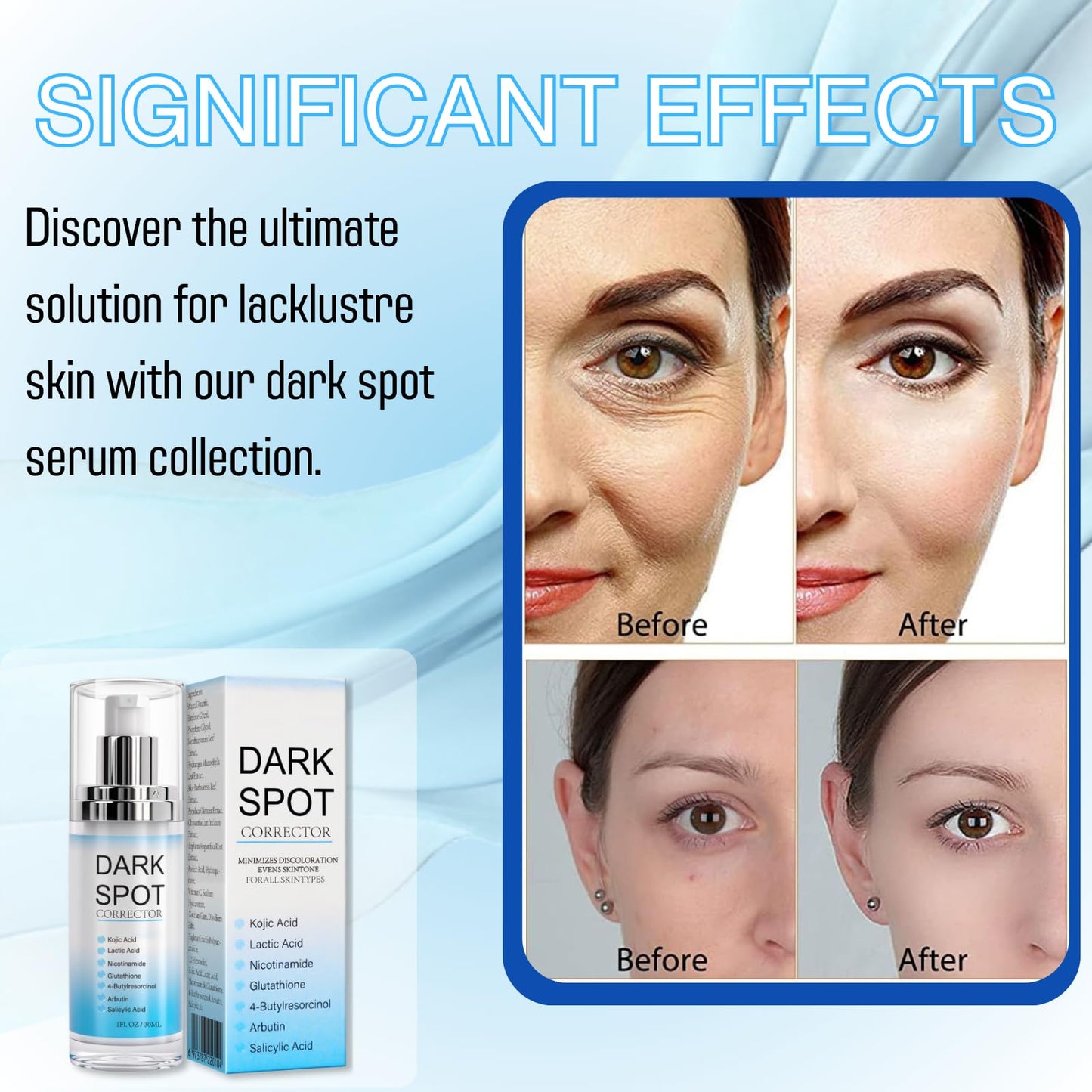 Dark Spot Remover for Face and Body, Enriching Skin Care for All Skin Tones, Dark Spot Corrector Freckle Remover, Spot Cream, Sunspots and Melasma with Alpha Arbutin,2% Niacinamide, 30ml