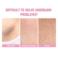 Sakura Brightening Gluta Underarm Cream,Underarm Whitening Cream,Whitening 50X Pearl Cap/Sules,Armpit Booster Serum,Body Whitening Cream for Dark Skin,Skin White-ning Cr-eam for Suit All Skin Types