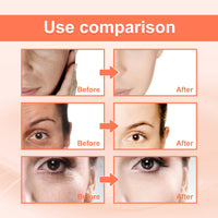 Rose Essential Oil, Facial Oil to Visibly Firm, Hydrate and Reveal Radiant Skin,Squalane + Vitamin C Rose Oil