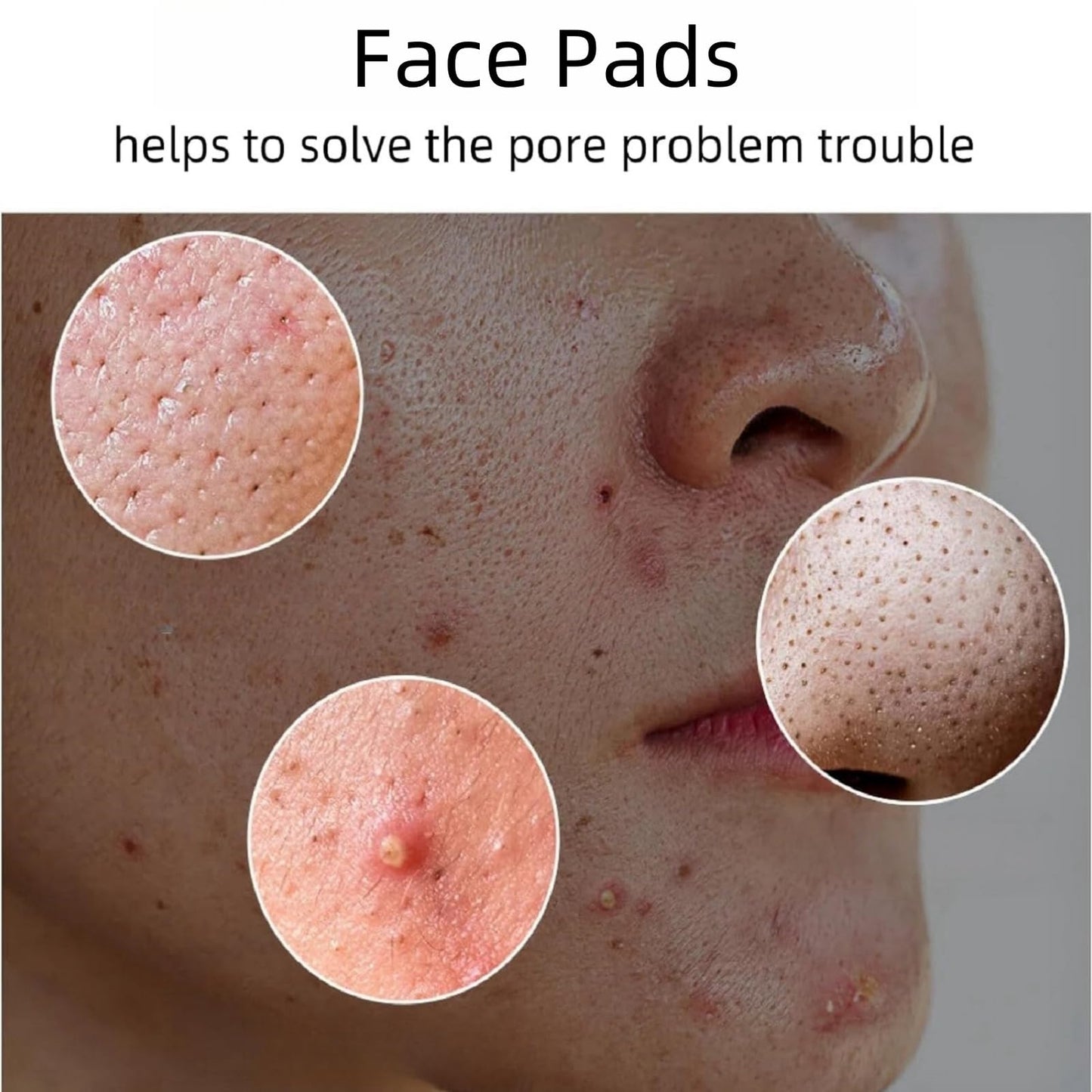 Ruojiar 70 Pads Zero Pore Pads,Dual-Textured Facial Toner Pa/ds for Exfoliation and Minimizing Pores,Face Cleansing Pa/ds,Shrink Po/res Facial Exfoliating P/ad,Korean Skin Care,Gentle Exfoliator Face