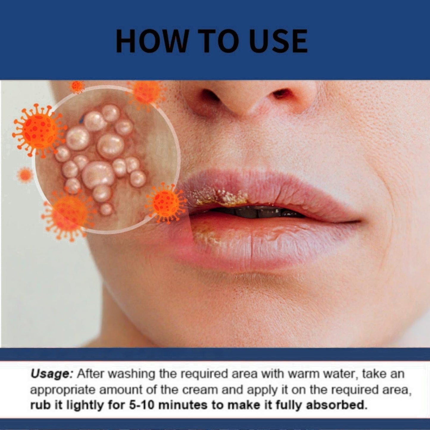 Cold Sore Cream,Cold Sore Treatment Cream,Mouth Ulcer Treatment for Adults,Gentle Sore Lips Treatment,Mouth Sore Treatment for Lips,Mouth Ulcer Gel,Fresh and Non-irritating,Natural Ingredients,20g