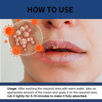 Cold Sore Cream,Cold Sore Treatment Cream,Mouth Ulcer Treatment for Adults,Gentle Sore Lips Treatment,Mouth Sore Treatment for Lips,Mouth Ulcer Gel,Fresh and Non-irritating,Natural Ingredients,20g