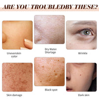 Seagril-Peptide Wrinkle Reducing Cream 12 Different Natural Peptides Seagrill Peptide Wrinkle Cream Peptide Moisturiser Peptide Wrinkle Reducing Cream Anti Wrinkle 5x Powerful for All Skin Types