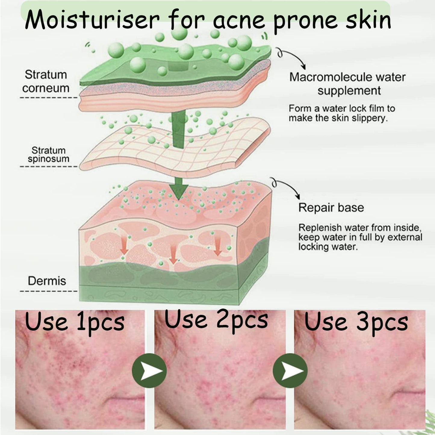 Acne Cream,Moisturiser Face Cream Spot Cream Mens Moisturiser Tea Tree Cream Spot Cream For Acne Cream Moisturiser for Women Men Teenagers Dilute Face Prone Spot Marks Balance Facial Oil Cream