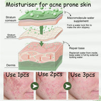 Acne Cream,Moisturiser Face Cream Spot Cream Mens Moisturiser Tea Tree Cream Spot Cream For Acne Cream Moisturiser for Women Men Teenagers Dilute Face Prone Spot Marks Balance Facial Oil Cream