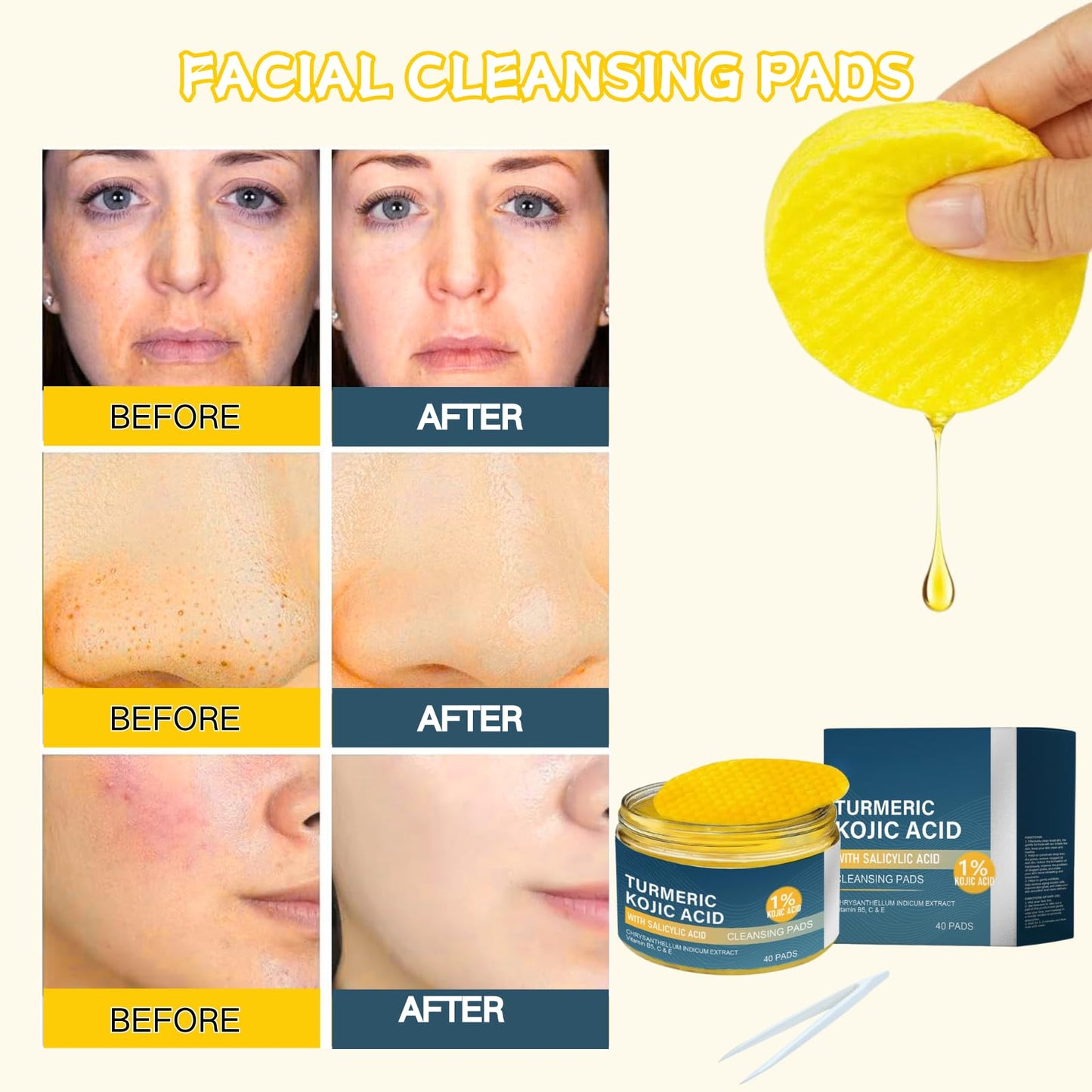 IZBEAUVO Turmeric Kojic Acid Cleansing Pads 40 - Turmeric Pads for Face Dark Spots, Face Exfoliator Pads, Dark Spot Remover for face, Turmeric Pads with Tweezers, Helps Balance Skin Oil And Water