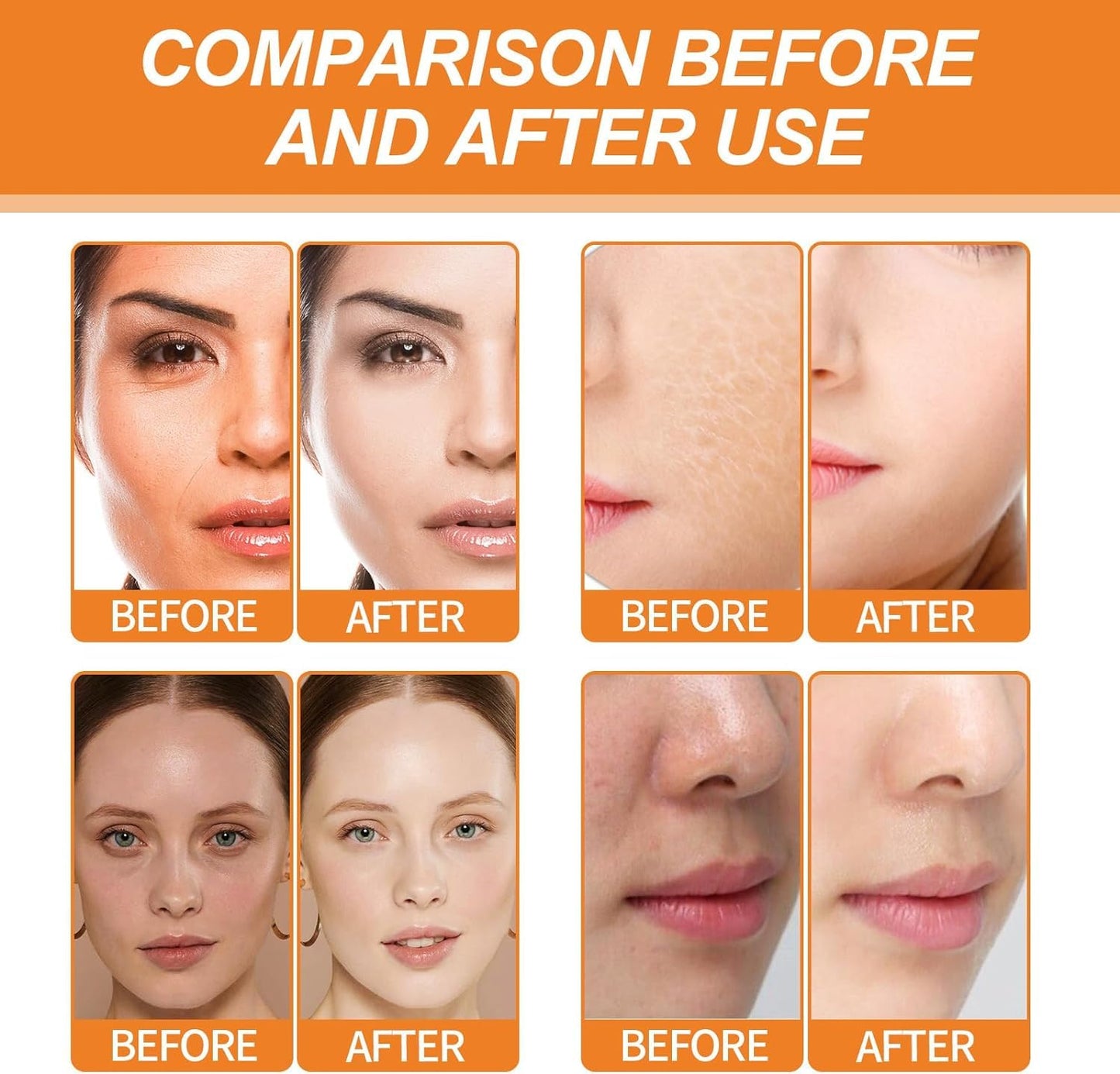 ChicNana Kojic Acid Turmeric Oil - Dark Spot Remover for Face - Kojic Acid Serum - Turmeric Oil Dark Spot Corrector - Kojic Acid Remove Facial Melasma Acne - Anti Aging Face Serum Moisturzing(2pc)