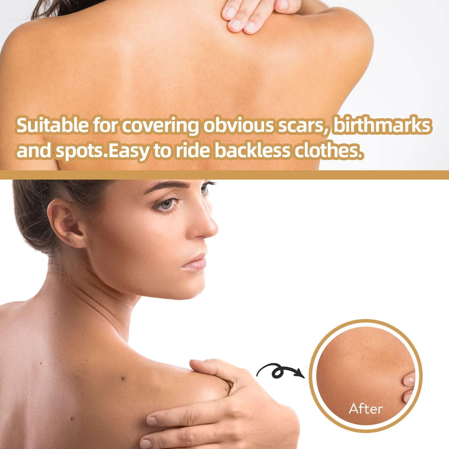 Siyinzu 6PCS Concealer Sticker,Invisible Scar Cover-Up,Breathable and Waterproof S-car Co-ver Stickers,Ultra Thin Patch for Scar,Concealer Stick-er for Covering Up Scars,Natural Con-cealer Stickers