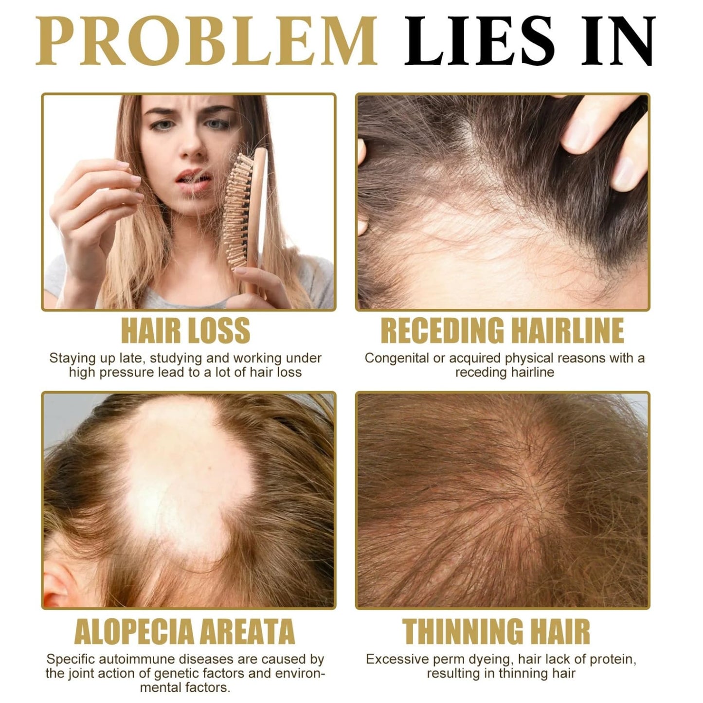 SingHao Hair Growth Roll-On Massage Essence,H/air G/rowth Serum,Roller Ball Ha/ir Care Oil,Scalp Roller,Ha/ir Treatment for Hai/r Lo/ss,Hai/r Growth Anti-Hair Lo/ss,H/air Loss Oil,Hair O/il Growth