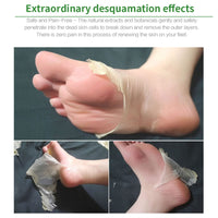 Tongyend Foot Peel Mask,3Pcs Natural Aloe Vera Gel Foot Mask,Foot Peel Mask For Hard Skin,Exfoliating Feet Peeling Socks,Foot Callus Remover,Foot Care,Feet Hard Skin Remover,Pedicure Sets For Feet (Aloe Vera)
