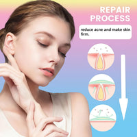 Oumun 15% Acid Acne Treatment Gel,Anti Acne Face Cream,Face Acne Treatment,Acid 15% Facial Serum Cream,Spot Treatment,Gentle Acne Cream,Spot Serum Cream for Face,Pimple Treatment Gel Cream,Face Gel for Acne