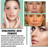 Hyaluronic Acid Powder for Daily Skincare,Hyaluronic Acid Jelly Mask for Face,Natural Hyaluronic Ac/id Powder for Face Skincare,Deep Hydration Smooths Wrinkles,Water-Soluble,Hydra/ting Masks