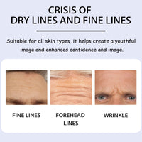 Aicocodida Forehead Wrinkle Patches 10pcs, Lavender Anti-Wrinkle Patches Smooth Fine Lines and Wrinkles with Collagen, Hyaluronic Acid, Pearl Extract(Lavender)