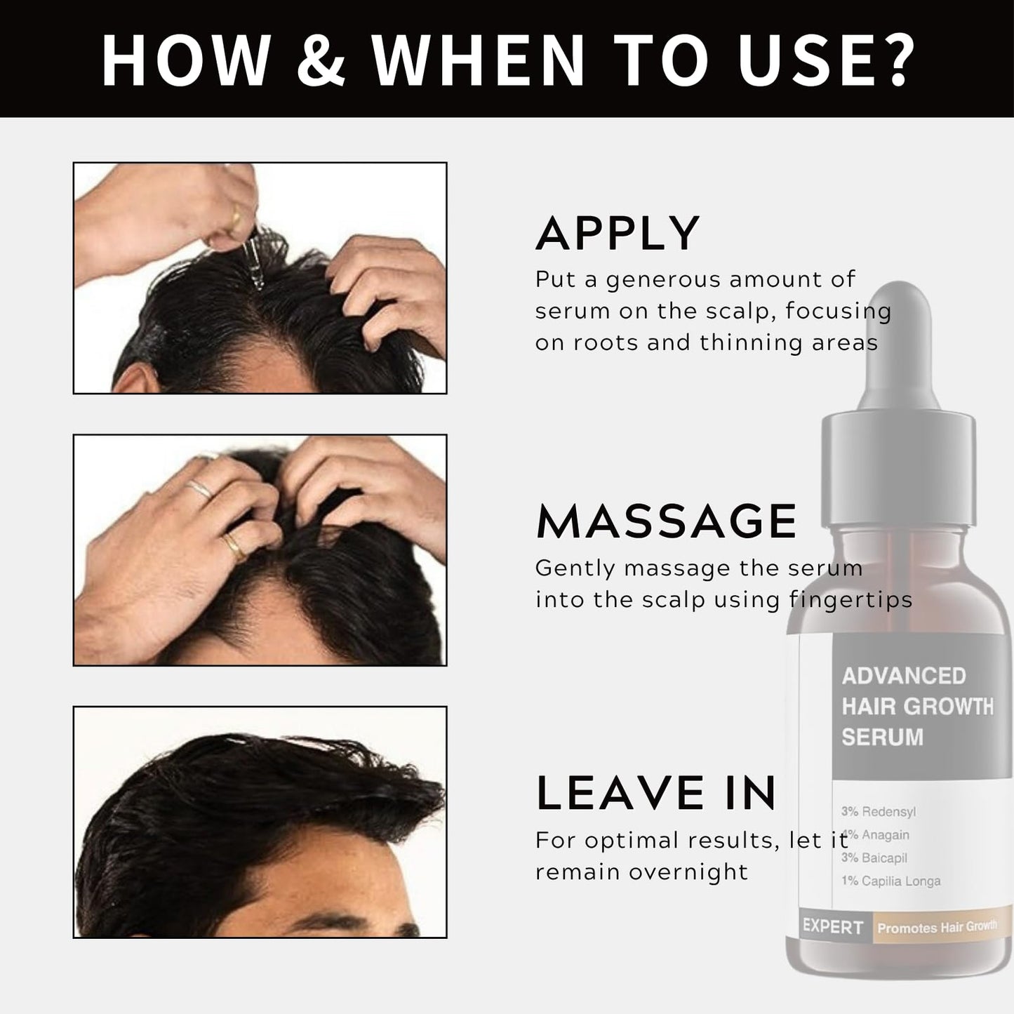 Lumiter Advanced Hair Growth Serum, Hair Growth Oil with Rosemary+Biotin+Redensyl+Anagain +Baicapil, Stimulate Hair Regrowth, Increase Hair Density, Hair Loss Treatments for Women Men, 30ml
