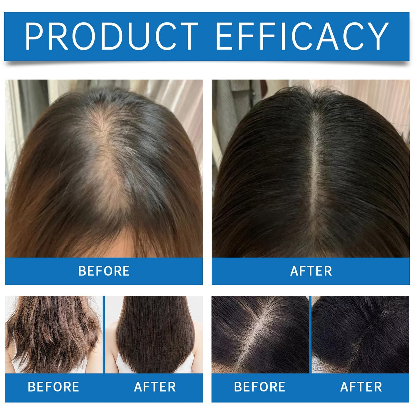 KAYZON 2PCS Scalp Serum, Scalpy Hair Growth Serum for Hair Loss, Scalp Cooling Hair Ampoule for Men & Women, Scalp Massager Hair Oil Improves Hair Shine, Repairs Follicles Stronger Hair Scalp Health