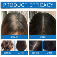 KAYZON 2PCS Scalp Serum, Scalpy Hair Growth Serum for Hair Loss, Scalp Cooling Hair Ampoule for Men & Women, Scalp Massager Hair Oil Improves Hair Shine, Repairs Follicles Stronger Hair Scalp Health