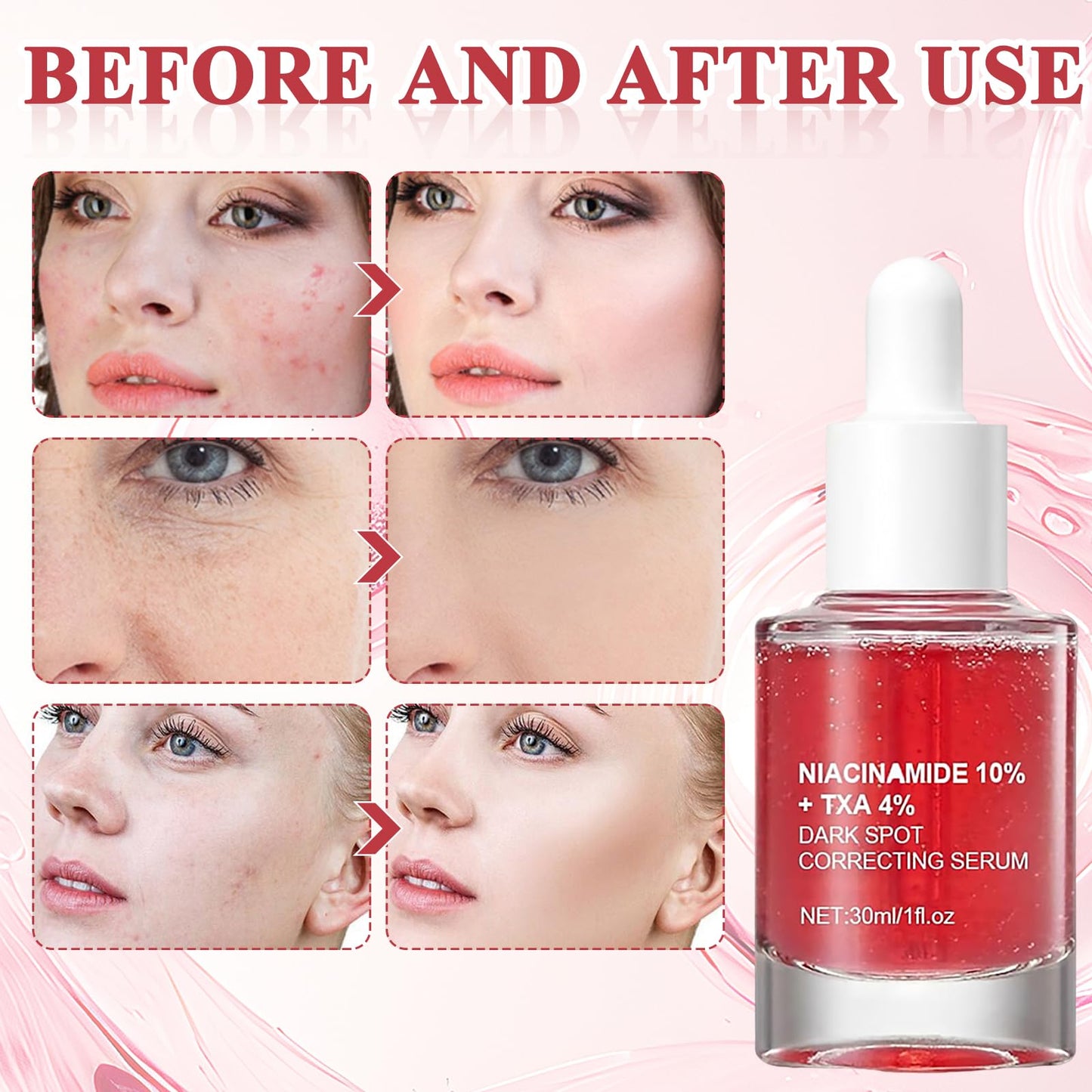 Belligern 2Pcs Dark Spot Correcting Serum,Niacinamide Serum Niacinamide Dark Spot Correcting Serum Targets Signs of Acne With 10% Niacinamide + 4% Tranexamic Acid Even Skin Tone,Fragrance-Free