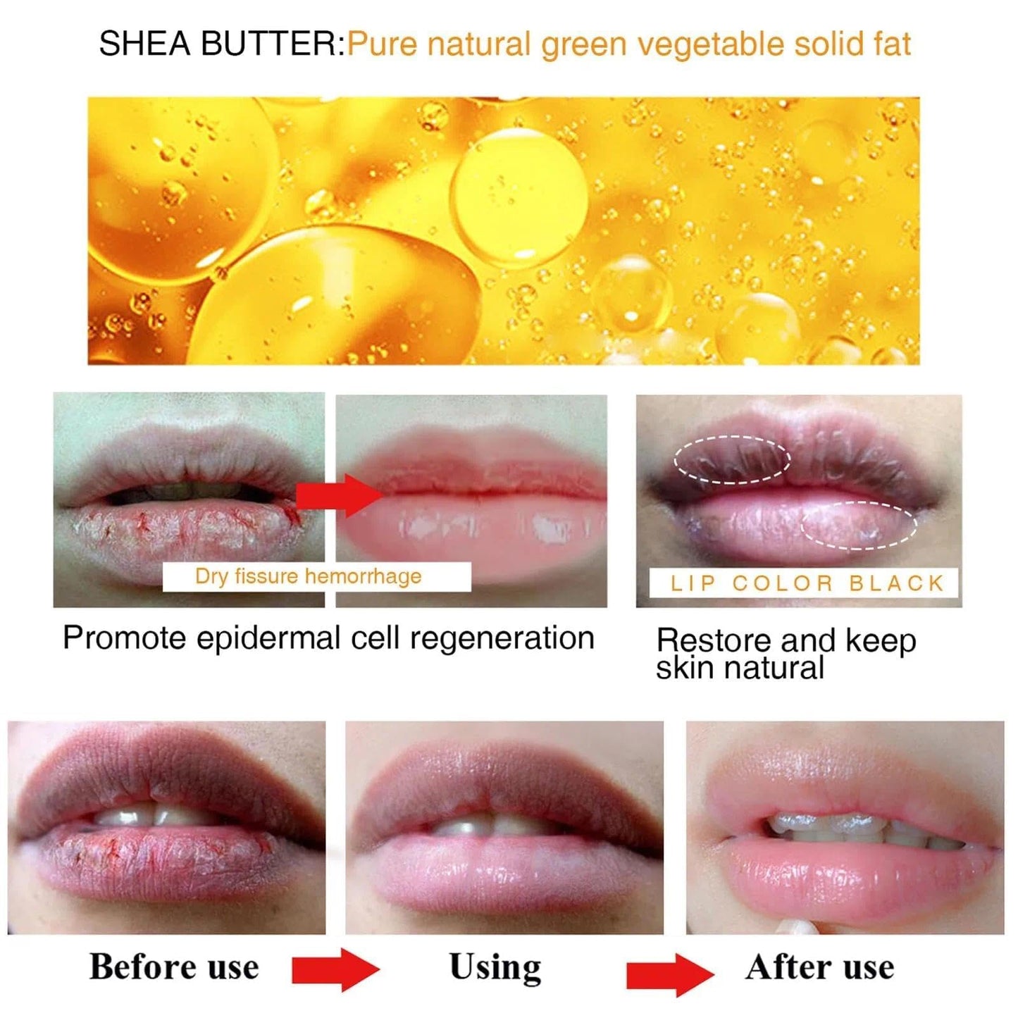 AurolaGlow Lip Care Lightens Remove Dark Lips, Moisturizing Lip Balm Whitening & Brightening, Lip Lightening For Dark Lips, Lip Balm Lips Pink Bleaching Cream Balm (1PCS)
