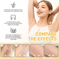 FunnAura 2 Pcs Cyperus Rotundus Oil, Organic Hair Removal Care Oil for Moisturizing and Soothing