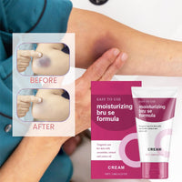 120g Moisturizing Bru/ise Cream,Dark Spot Corrector for Brui/sing,Skin Repair Cream,Arnica Cream for Brui/sing & Swelling,Moisturizing Bru/ise Formula Cre/am,Restore & Rejuvenate,Skin Relief & Repair