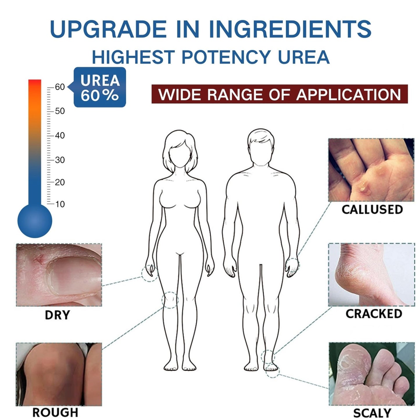 60% Urea Cream - Cracked Heel Repair Cream - Urea Foot Cream with Salicylic Acid, Aloe Vera- Foot Cream for Cracked Heels and Dry Skin - Skin Care for Foot Moisturiser (3PCS)