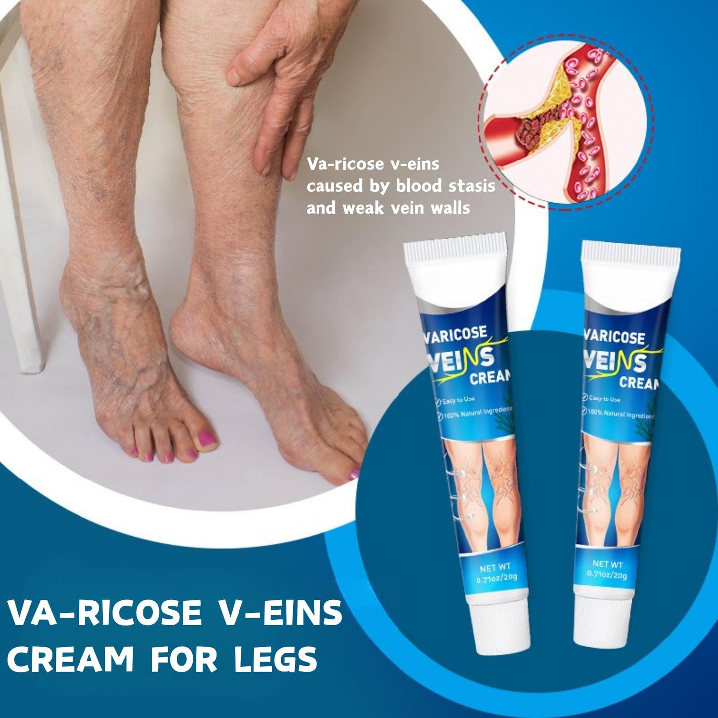2PCS Va-ricose V-eins Cream, Va-ricose V-eins Treatment for Legs, Herbal Balm to Reduce Swelling in Feet and Legs, Spider v-eins Repair Cream for Women & Men, Vegan Legs Swelling Relief, 20g × 2